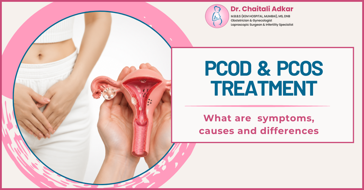 PCOD and PCOS: Symptoms, Causes, Differences & Treatment Options
